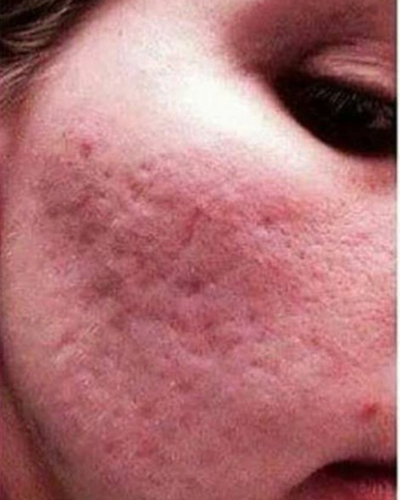 <p>Dull, Uneven Skin Tone?</p>